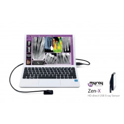 Myray Zen-x size 1 RVG