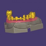 exocad DentalCAD (Basic Modül)